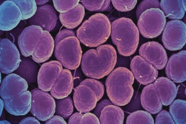 Micografía electrónica de barrido coloreada de la bacteria Neisseria gonorrhoeae bacteria, que causa gonorrea. (NIAID via Flickr)