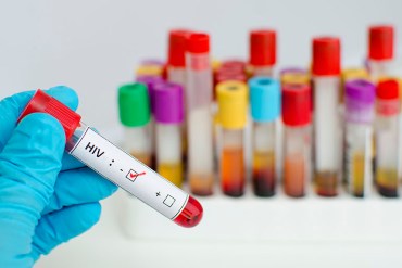 Blood sample with HIV negative