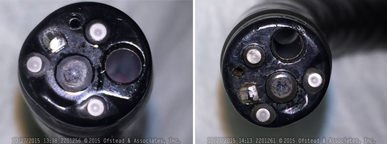 Damaged ends of scopes. Left, scratched, cloudy lens. Right, scratched, scaly lens and dents, brown debris around channel outlets. (Courtesy of Ofstead & Associates Inc., American Journal of Infection Control)
