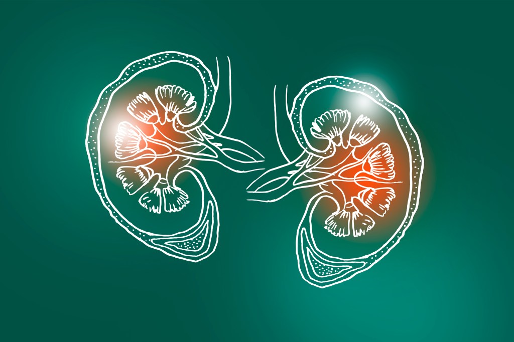 An illustration shows a drawing of kidneys with red coloring, suggesting disease, against a green backdrop.