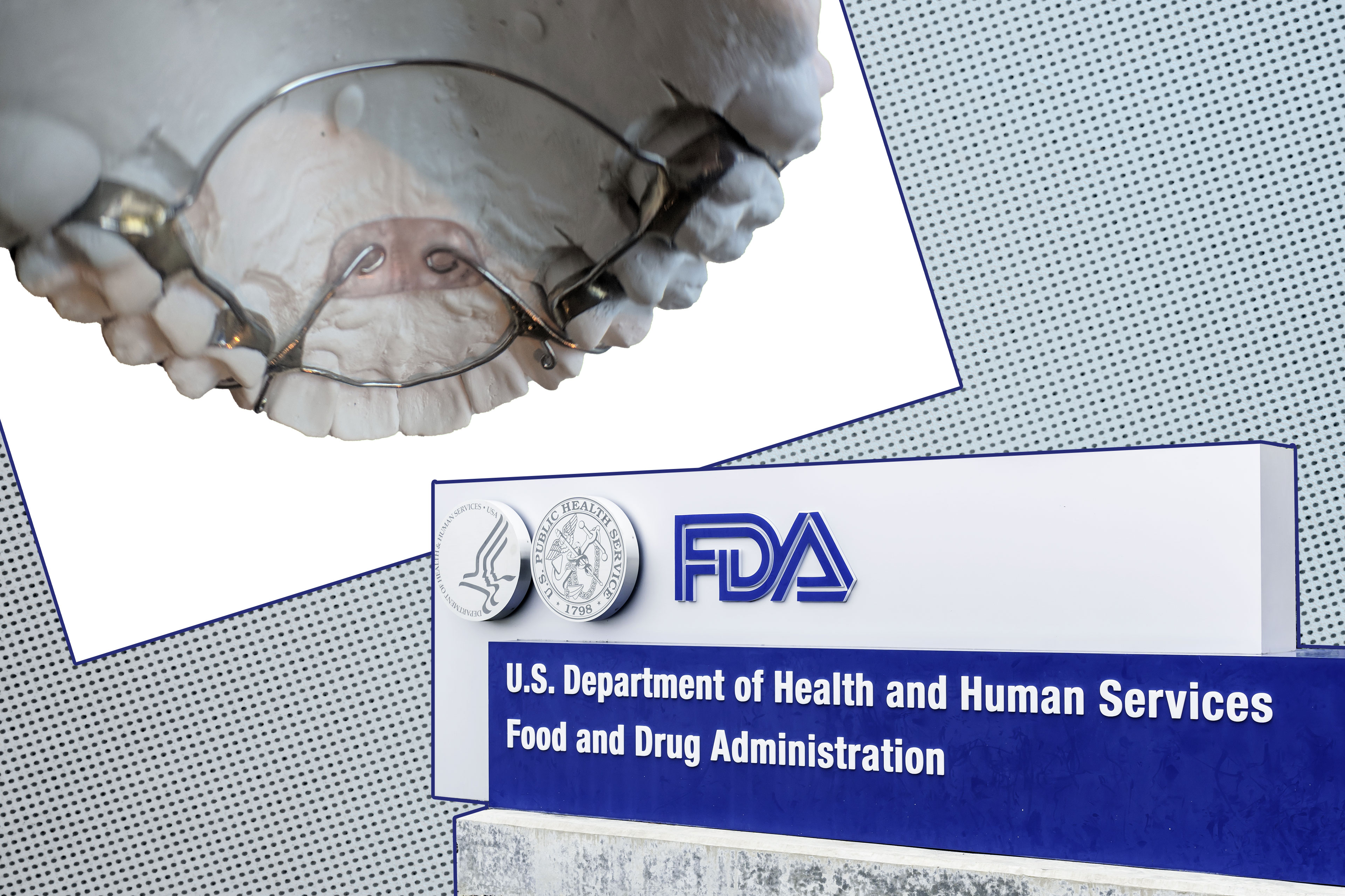 FDA Evaluates ‘Safety Concerns’ Over Dental Devices Featured in KHN-CBS Investigation