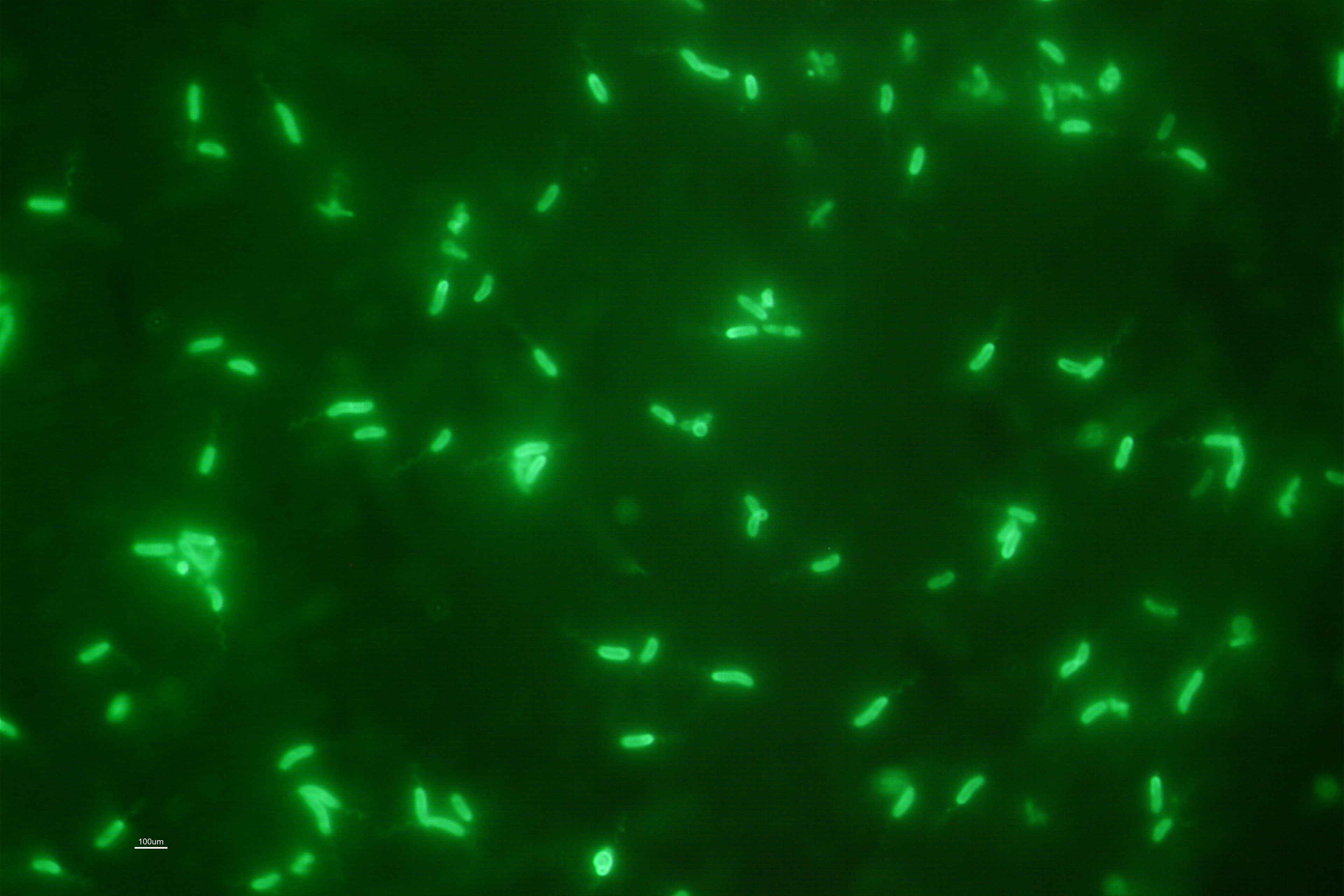 A photo of a green magnified image of bacteria.