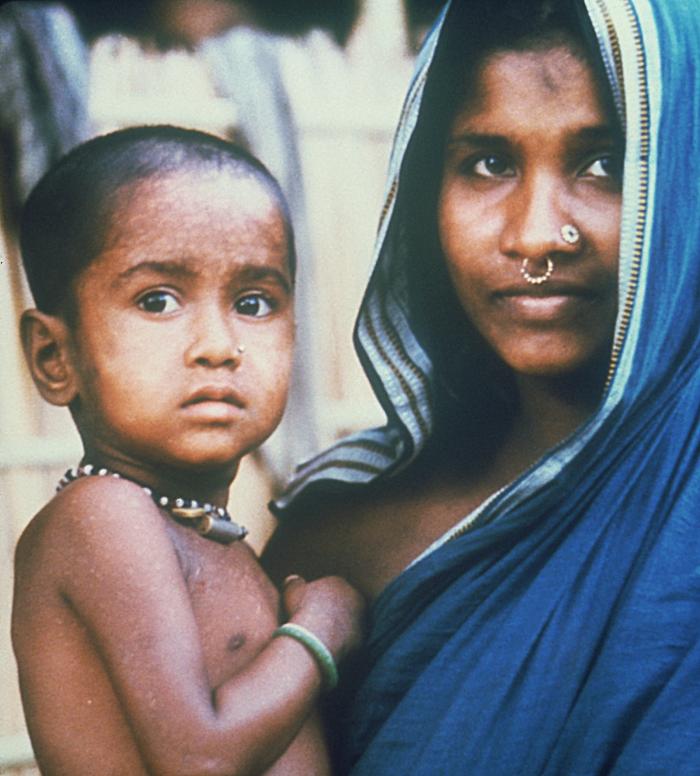 A color photograph from 1975 shows Rahima Banu as a toddler, being held by her mother. Healed smallpox scars are faintly visible on Banu’s skin. Both she and her mother look toward the camera.