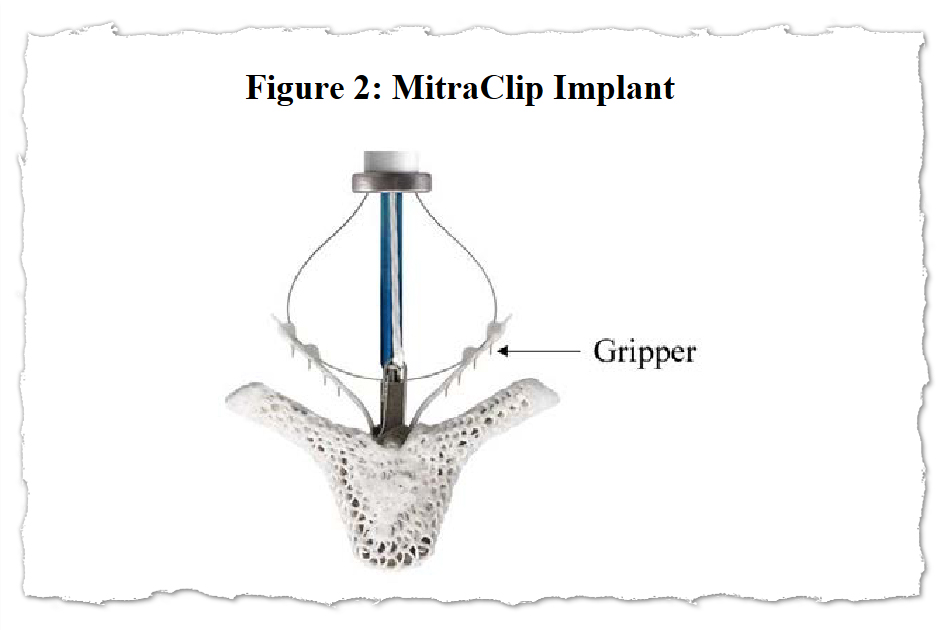 An extract from an FDA document showing the MitraClip's clip.